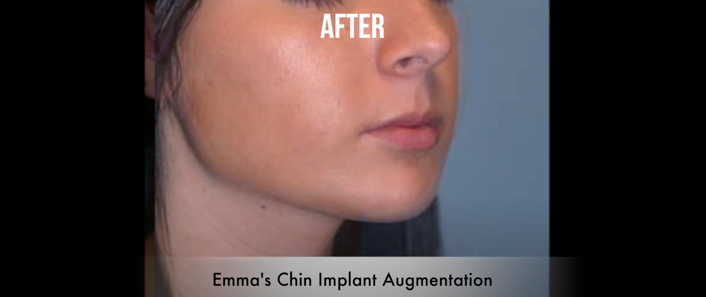 Patient testimonial case emma thum